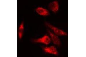ABIN6275667 staining  COLO205 cells by IF/ICC.