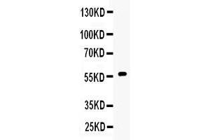Western blot analysis of CYP17A1 expression in 22RV1 whole cell lysates ( Lane 1). (CYP17A1 anticorps  (C-Term))