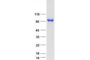 Validation with Western Blot