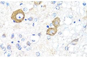 Immunohistochemistry of paraffin-embedded Rat brain using NRG4 Polyclonal Antibody at dilution of 1:100 (40x lens). (Neuregulin 4 anticorps)