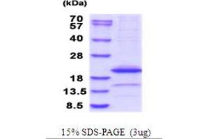 SDS-PAGE (SDS) image for Interleukin 1 alpha (IL1A) (AA 115-270) protein (His tag) (ABIN5853944)