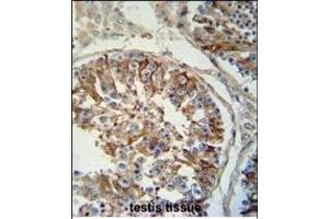 SACA1 antibody (N-term) (ABIN654730 and ABIN2844418) immunohistochemistry analysis in formalin fixed and paraffin embedded human testis tissue followed by peroxidase conjugation of the secondary antibody and DAB staining. (SPACA1 anticorps  (N-Term))