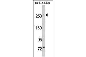 Western blot analysis of LRRK1 in mouse bladder tissue lysates (35ug/lane) (LRRK1 anticorps  (C-Term))