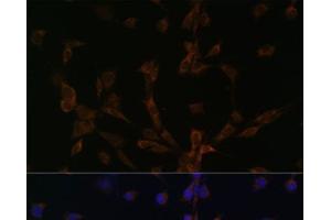 Immunofluorescence analysis of NIH/3T3 cells using DYNLL2 Polyclonal Antibody at dilution of 1:100.