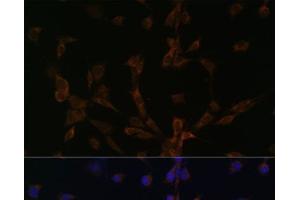 Immunofluorescence analysis of NIH/3T3 cells using DYNLL2 Polyclonal Antibody at dilution of 1:100. (DYNLL2 anticorps)