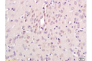 Formalin-fixed and paraffin embedded rat brain labeled with Rabbit Anti Annexin A13 Polyclonal Antibody, Unconjugated (ABIN735323) at 1:200 followed by conjugation to the secondary antibody and DAB staining (MSH alpha (AA 138-150) anticorps)