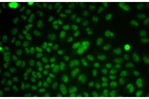 Immunofluorescence analysis of HeLa cells using CSNK2A2 Polyclonal Antibody (CSNK2A2 anticorps)