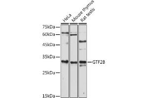 Western blot analysis of extracts of various cell lines, using GTF2B antibody (ABIN7267370) at 1:1000 dilution. (GTF2B anticorps  (AA 50-150))