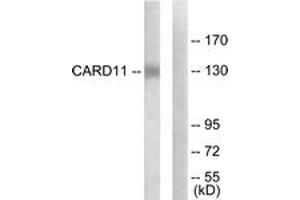 Western blot analysis of extracts from COLO205 cells, using CARD11 Antibody. (CARD11 anticorps  (AA 10-59))