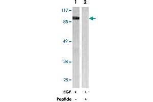 Western blot analysis of extracts from HeLa cells, treated with EGF (200 ng/mL, 30 mins), using CALD1 polyclonal antibody . (Caldesmon anticorps)