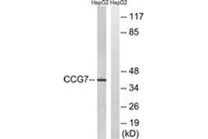 Western blot analysis of extracts from HepG2 cells, using CACNG7 Antibody. (CACNG7 anticorps  (AA 198-247))