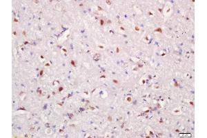 Formalin-fixed and paraffin embedded rat brain tissue labeled with Rabbit Anti-Hrk Polyclonal Antibody, Unconjugated (ABIN2559409) at 1:200 followed by conjugation to the secondary antibody and DAB staining (HRK anticorps  (AA 1-50))