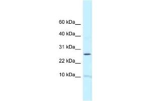 Western Blot showing RPL39 antibody used at a concentration of 1 ug/ml against Fetal Brain Lysate (RPL39 anticorps  (N-Term))