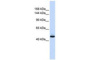 Image no. 1 for anti-Growth Regulation By Estrogen in Breast Cancer 1 (GREB1) (AA 36-85) antibody (ABIN6740577) (GREB1 anticorps  (AA 36-85))