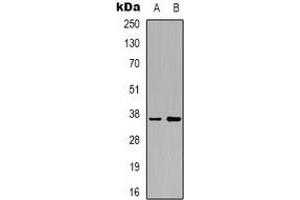 Western blot analysis of AKR1C2 expression in HepG2 (A), Hela (B) whole cell lysates. (AKR1C2 anticorps)