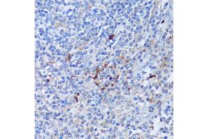 Immunohistochemistry of paraffin-embedded Human tonsil using P antibody (ABIN7269207) at dilution of 1:100 (40x lens). (PAD4 anticorps  (AA 374-550))