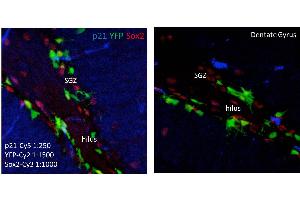Immunohistochemistry of Mouse anti-p21 antibody.
