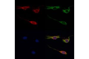 ABIN6259651 and ABIN6268999 staining HepG2 by IF/ICC. (Serotonin Receptor 1A anticorps  (Internal Region))