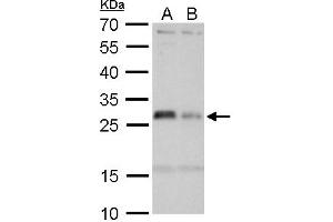 WB Image HLA-DMA antibody detects HLA-DMA protein by Western blot analysis.