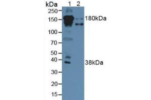 Western blot analysis of (1) Human Serum and (2) Human Liver Tissue. (Complement Factor H anticorps  (AA 860-1231))