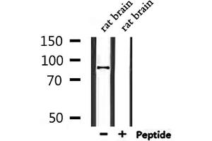Western blot analysis of extracts from rat brain, using CDH26 Antibody. (CDH26 anticorps  (N-Term))