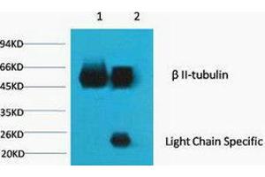 Immunoprecipitation (IP) analysis: 1) Input: Mouse Brain Tissue Lysate. (TUBB2A anticorps)