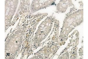 ABIN6257502 and ABIN6274398 at 1/100 staining human normal colon tissue by IHC-P. (STEAP4 anticorps  (C-Term))