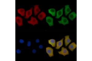 IL12B Mouse Monoclonal Antibody staining HepG2 cells by IF/ICC. (IL12B anticorps  (C-Term))
