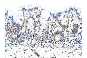 PRKRA antibody was used for immunohistochemistry at a concentration of 4-8 ug/ml to stain Epithelial cells of fundic gland (arrows) in Human Stomach. (PRKRA anticorps  (Middle Region))