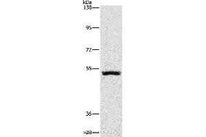 Western blot analysis of Mouse kidney tissue, using SYT17 Polyclonal Antibody at dilution of 1:650 (SYT17 anticorps)