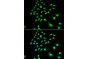 Immunofluorescence analysis of U2OS cells using UBE3C antibody (ABIN5973842). (UBE3C anticorps)