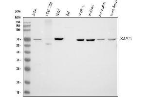 Western blot analysis of ZAP70 using anti-ZAP70 antibody (ABIN4886773).
