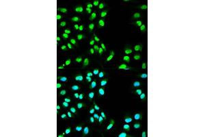 Immunofluorescence analysis of HeLa cell using MCM3 antibody.