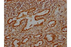 IHC image of ABIN7159372 diluted at 1:100 and staining in paraffin-embedded human lung tissue performed on a Leica BondTM system. (MBTPS1 anticorps  (AA 187-400))
