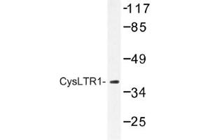 Image no. 1 for anti-Cysteinyl Leukotriene Receptor 1 (CYSLTR1) antibody (ABIN317631)
