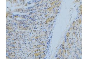 ABIN6277300 at 1/100 staining Human gastric tissue by IHC-P.