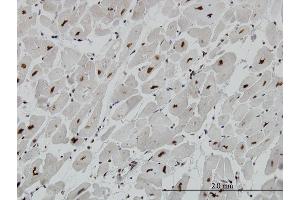 Immunoperoxidase of monoclonal antibody to MECP2 on formalin-fixed paraffin-embedded human heart. (MECP2 anticorps  (AA 81-170))