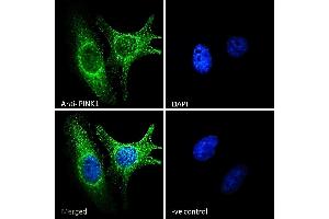 (ABIN334460) Immunofluorescence analysis of paraformaldehyde fixed HeLa cells, permeabilized with 0.