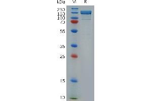 Human IL17RB Protein, His Tag on SDS-PAGE under reducing condition.