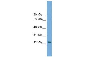 WB Suggested Anti-RAB15 Antibody Titration: 0. (RAB15 anticorps  (Middle Region))