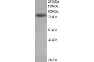 Western Blotting (WB) image for anti-NDC80 Kinetochore Complex Component Homolog (NDC80) (C-Term) antibody (ABIN2465807) (NDC80 anticorps  (C-Term))