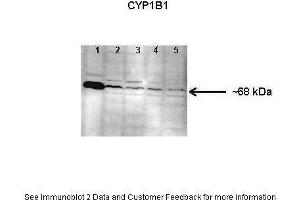Lanes:  Lane 1: Human lung microsome lysate Lane 2-5: 150 ug mouse lung microsome lysate Primary Antibody Dilution:  1: 1000 Secondary Antibody:  Anti-rabbit HRP Secondary Antibody Dilution:  1: 10000 Gene Name:  CYP1B1 Submitted by:  Jing Peng, Fox Chase Cancer Center