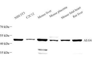 Western blot analysis of ALG6 (ABIN7073127) at dilution of 1: 1000 (ALG6 anticorps)