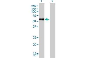 Western Blot analysis of FGL2 expression in transfected 293T cell line by FGL2 monoclonal antibody (M01), clone 6D9.