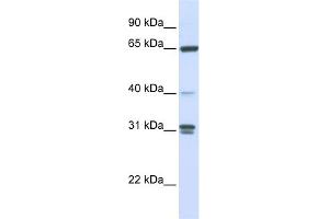WB Suggested Anti-GBP2 Antibody Titration: 0. (GBP2 anticorps  (N-Term))