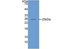 Western blot analysis of recombinant Mouse COMP. (COMP anticorps  (AA 554-753))