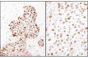 Immunohistochemistry (IHC) image for anti-Minichromosome Maintenance Complex Component 2 (MCM2) (pSer41) antibody (ABIN7449367) (MCM2 anticorps  (pSer41))