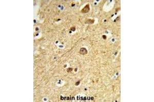 Immunohistochemistry (IHC) image for anti-Mitogen-Activated Protein Kinase 8 Interacting Protein 1 (MAPK8IP1) antibody (ABIN3004004)