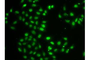 Immunofluorescence analysis of MCF-7 cells using DUSP22 antibody (ABIN4903528). (DUSP22 anticorps)