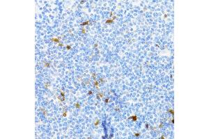 Immunohistochemistry of paraffin-embedded human tonsil using PVALB Antibody (ABIN5971476) at dilution of 1/100 (40x lens). (PVALB anticorps)